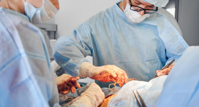 surgeon-assistant-conducting-abdominoplasty-surgery-clinic